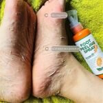 Exfoliante de pies en spray - Imagen 6