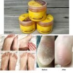 Crema Exfoliante para pies de miel - Imagen 2