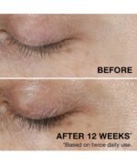 Crema en gel de Neutrogena piel seca - Imagen 4