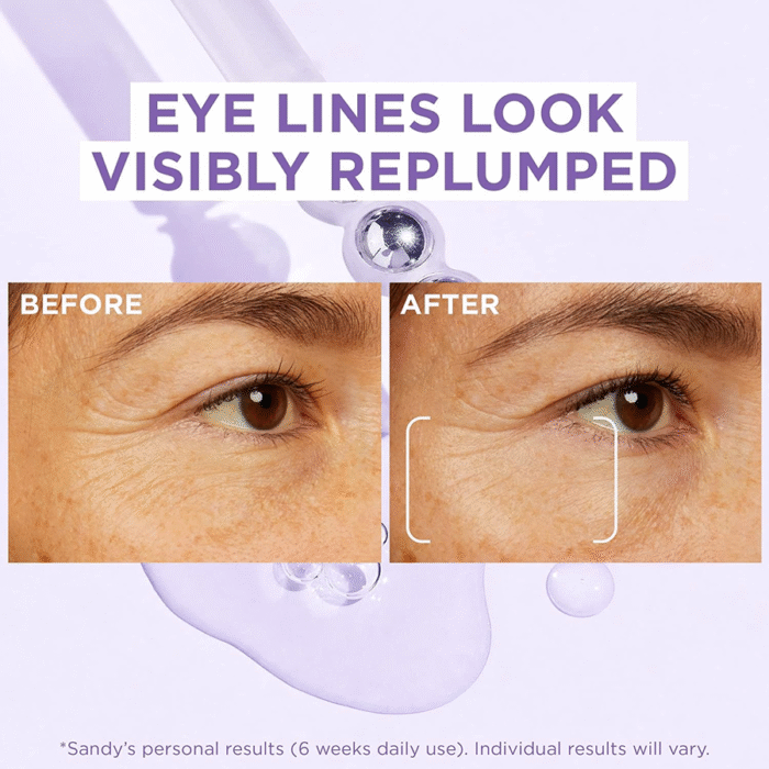 Serum de ojos de Hyaluronic Acid and Caffeina, Revitalift Filler Eye Serum, rellena, ilumina y deshincha los ojos - Imagen 4