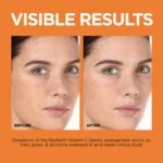 L’Oréal Paris Revitalift - Suero de vitamina C 12% puro, vitamina E, ácido salicílico, hidratante, suavizante e iluminador, muestra no grasosa + hidratante - Imagen 2