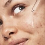 e.l.f 
Blemish Breakthrough Triple-Acid Resurfacing Serum - Imagen 4