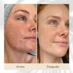 Acido salicílico de The ordinary The Ordinary Salicylic Acid 2% Anhydrous Solution - Imagen 3