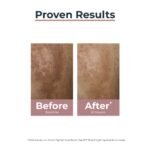 EUCERIN EL SUERO DUAL ANTIPIGMENTACIÓN REDUCE LAS MANCHAS PIGMENTARIAS - Imagen 4